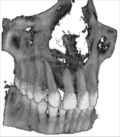 3D-Röntgen